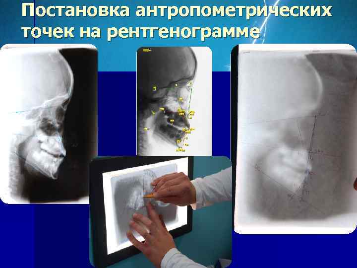 Функциональные методы диагностики в ортодонтии презентация