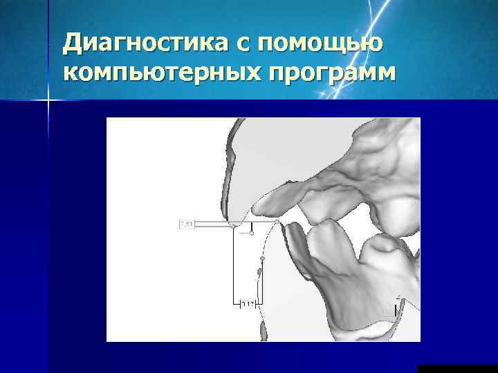 Функциональные методы диагностики в ортодонтии презентация