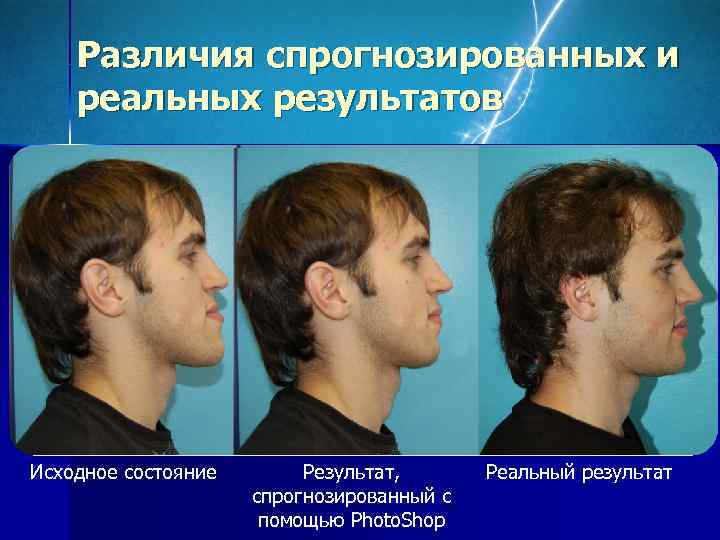   Различия спрогнозированных и реальных результатов Исходное состояние  Результат,  Реальный результат