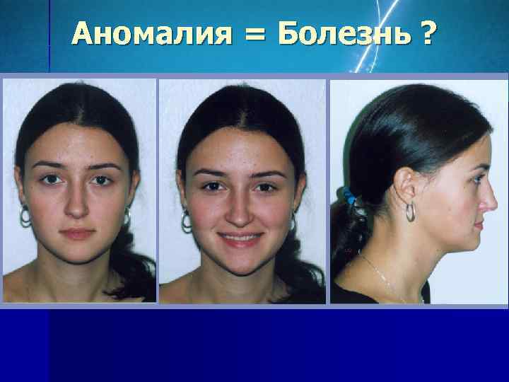 Аномалия = Болезнь ? 