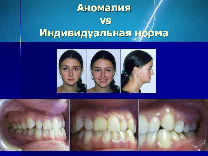  Аномалия   vs Индивидуальная норма 