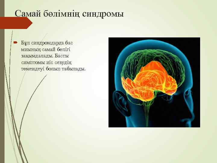 Самай бөлімнің синдромы  Бұл синдромдарда бас  миының самай бөлігі  зақымдалады. Басты