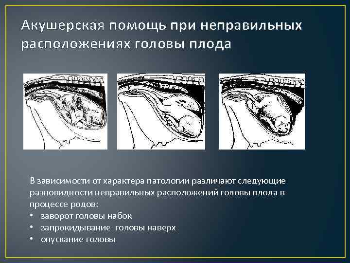 Роды презентация по акушерству