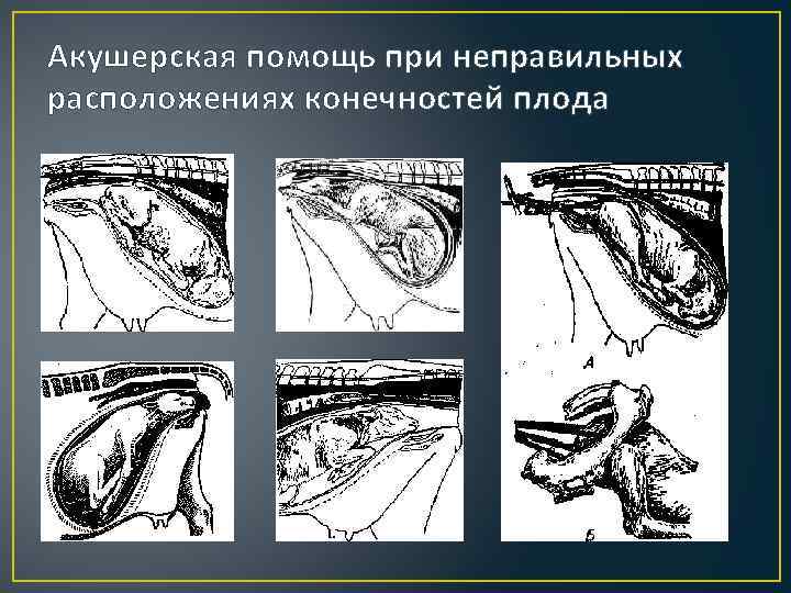 Презентация акушерская тактика при домашних родах