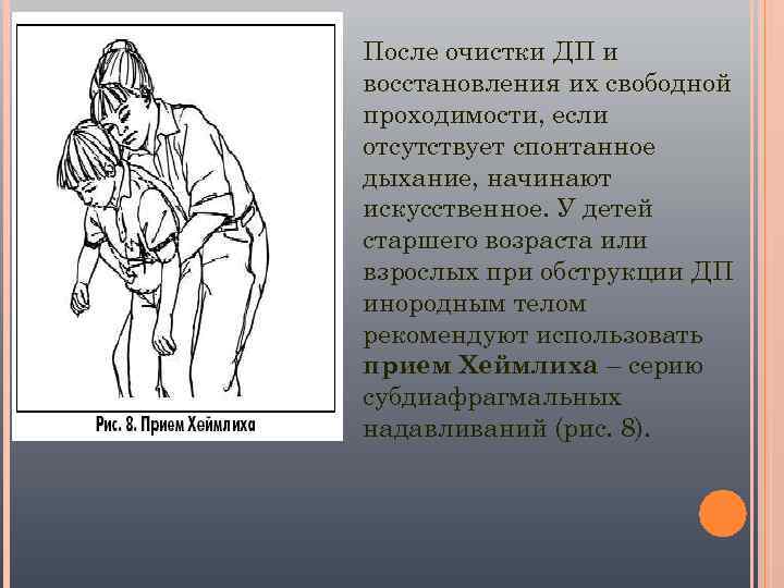 После очистки ДП и восстановления их свободной проходимости, если отсутствует спонтанное дыхание, начинают искусственное.