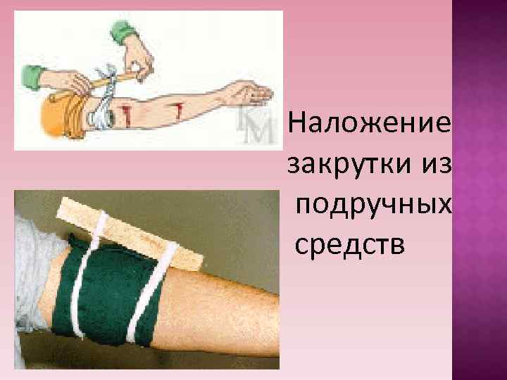 Наложение закрутки из подручных средств Наложение закрутки из подручных средств