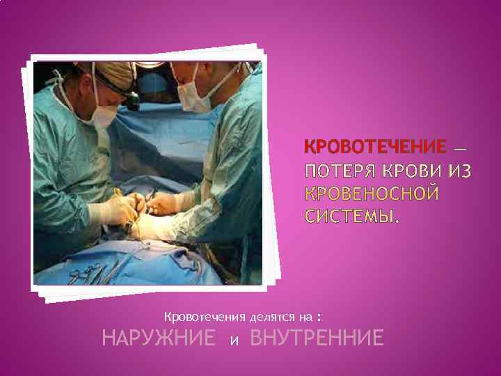 КРОВОТЕЧЕНИЕ Кровотечения делятся на : НАРУЖНИЕ И КРОВОТЕЧЕНИЕ Кровотечения делятся на : НАРУЖНИЕ И