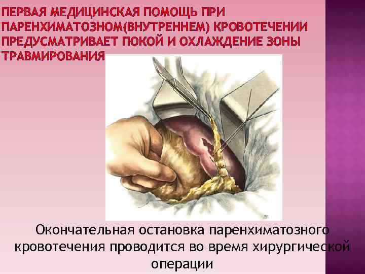 ПЕРВАЯ МЕДИЦИНСКАЯ ПОМОЩЬ ПРИ ПАРЕНХИМАТОЗНОМ(ВНУТРЕННЕМ) КРОВОТЕЧЕНИИ ПРЕДУСМАТРИВАЕТ ПОКОЙ И ОХЛАЖДЕНИЕ ЗОНЫ ТРАВМИРОВАНИЯ ПЕРВАЯ МЕДИЦИНСКАЯ ПОМОЩЬ ПРИ ПАРЕНХИМАТОЗНОМ(ВНУТРЕННЕМ) КРОВОТЕЧЕНИИ ПРЕДУСМАТРИВАЕТ ПОКОЙ И ОХЛАЖДЕНИЕ ЗОНЫ ТРАВМИРОВАНИЯ