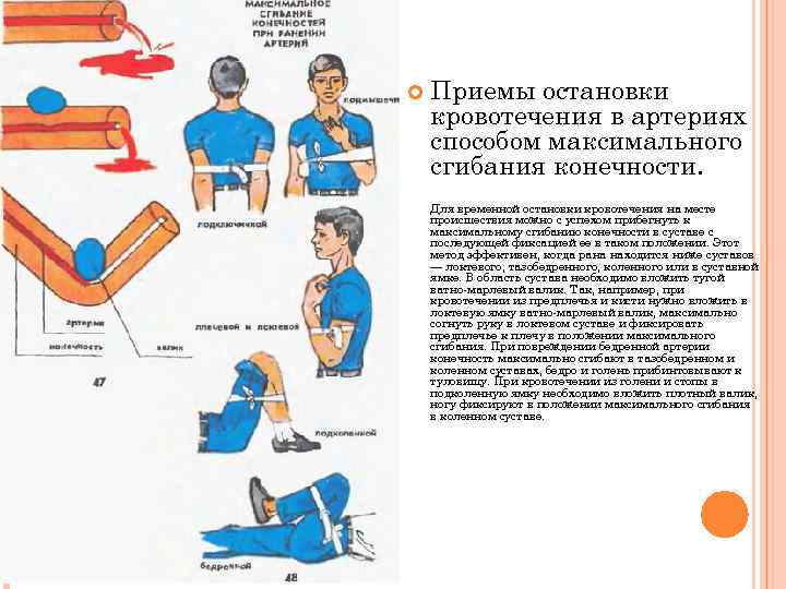   Приемы остановки кровотечения в артериях способом максимального сгибания конечности. Для временной остановки