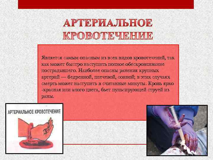 Является самым опасным из всех видов кровотечений, так как может быстро наступить полное обескровливание