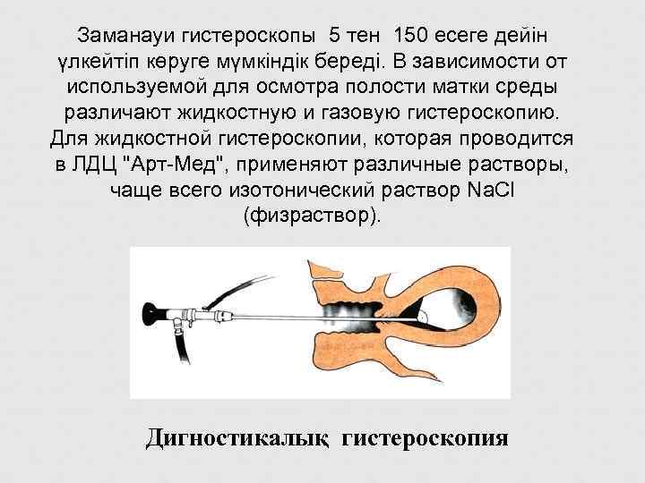  Заманауи гистероскопы 5 тен 150 есеге дейін үлкейтіп көруге мүмкіндік береді. В зависимости