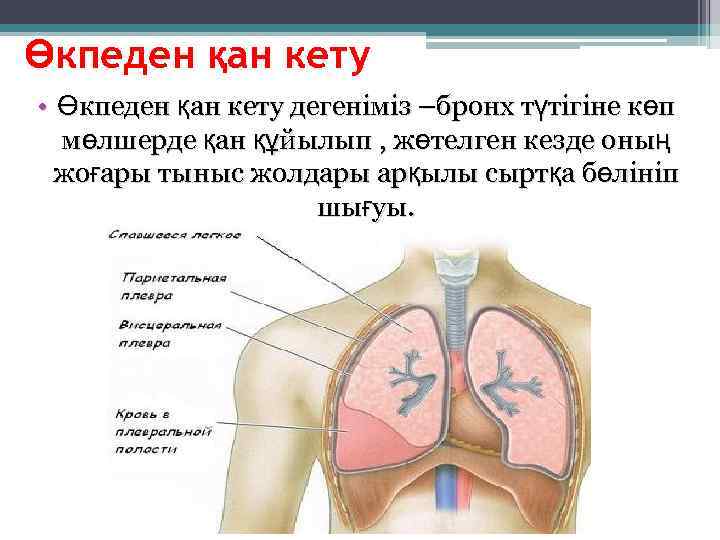 Өкпеден қан кету • Өкпеден қан кету дегеніміз –бронх түтігіне көп  мөлшерде қан