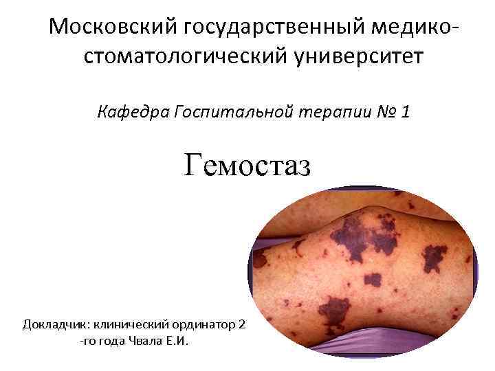 Московский государственный медико- стоматологический университет Кафедра Госпитальной терапии № 1 Московский государственный медико- стоматологический университет Кафедра Госпитальной терапии № 1