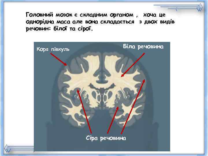 Головний мозок є складним органом , хоча це однорідна маса але вона складається з