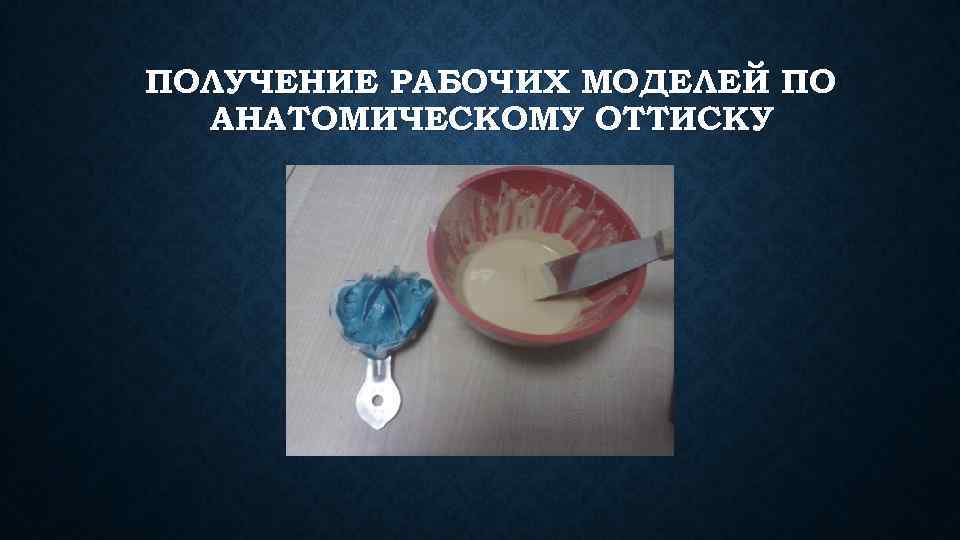 ПОЛУЧЕНИЕ РАБОЧИХ МОДЕЛЕЙ ПО  АНАТОМИЧЕСКОМУ ОТТИСКУ 