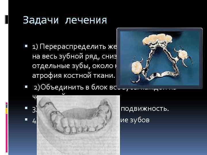 Задачи лечения  1) Перераспределить жевательное давление  на весь зубной ряд, снизить нагрузку