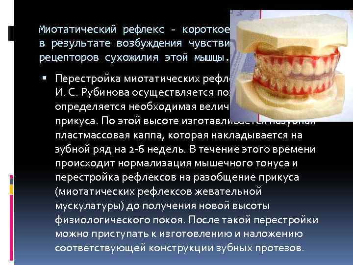 Миотатический рефлекс - короткое сокращение мышцы в результате возбуждения чувствительных рецепторов сухожилия этой мышцы.