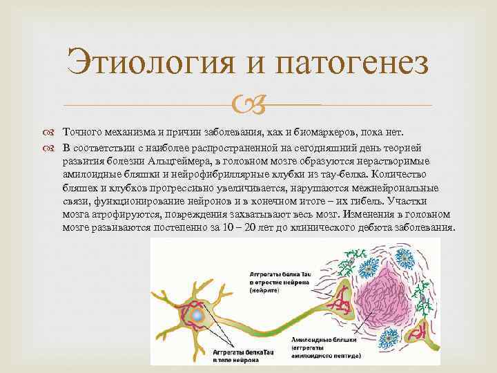   Этиология и патогенез   Точного механизма и причин заболевания, как и