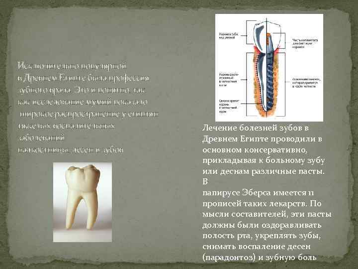 Исключительно популярной в Древнем Египте была профессия зубного врача. Это и понятно, так как