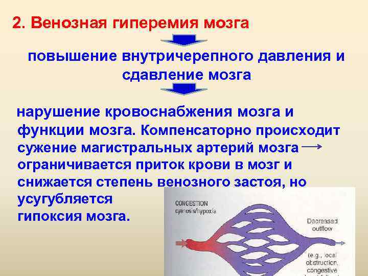  2. Венозная гиперемия мозга  повышение внутричерепного давления и    