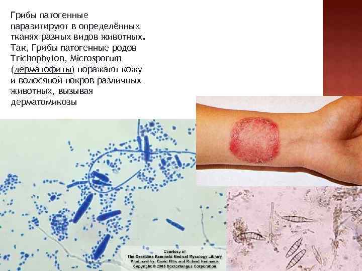 Грибы патогенные паразитируют в определённых тканях разных видов животных. Так, Грибы патогенные родов Trichophyton,