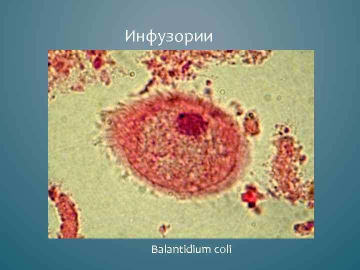Инфузории  Balantidium coli 