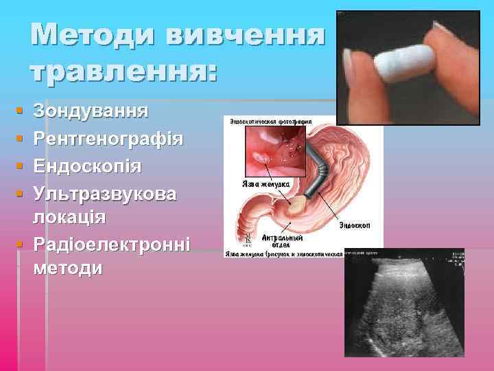 Методи вивчення травлення: § § Зондування Рентгенографія Ендоскопія Ультразвукова локація § Радіоелектронні методи 