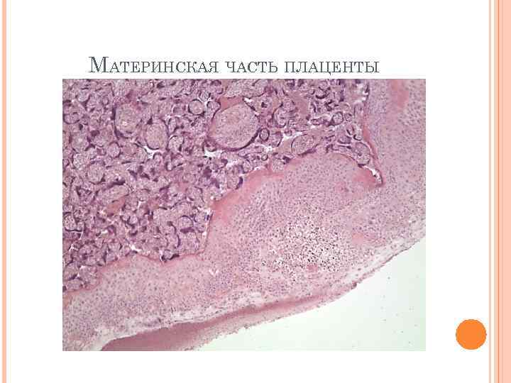 Плацента гистология. Материнская часть плаценты гистология. Препарат материнская часть плаценты препарат. Плацента материнская и плодная часть. Плодовая часть плаценты.