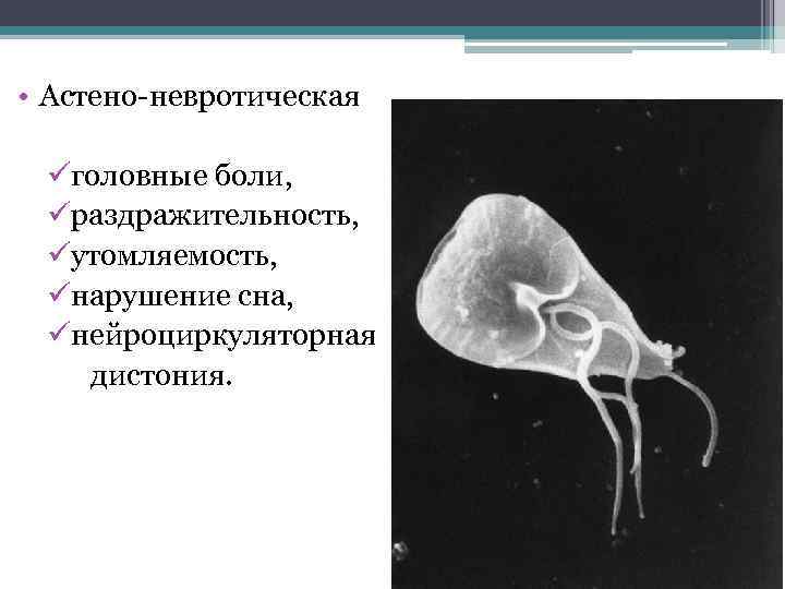  • Астено-невротическая üголовные боли, üраздражительность, üутомляемость, üнарушение сна, üнейроциркуляторная дистония. 