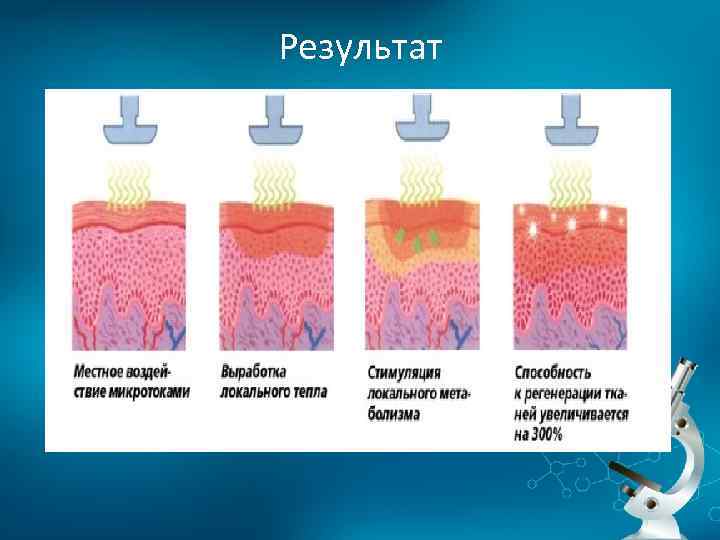 Результат 