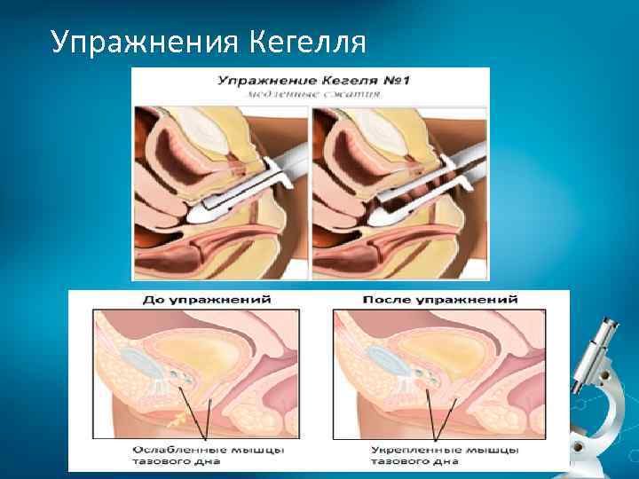 Упражнения Кегелля 