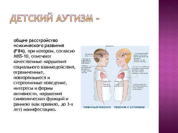 общее расстройство психического развития (F 84), при котором, согласно МКБ-10, отмечают качественные нарушения социального