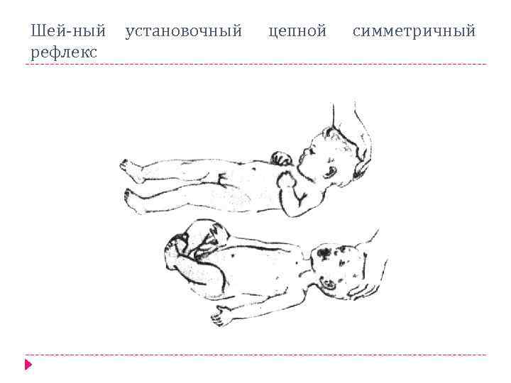 Шей ный установочный рефлекс цепной симметричный 