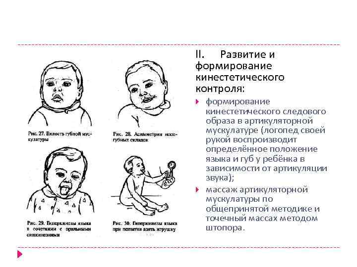 II. Развитие и формирование кинестетического контроля: формирование кинестетического следового образа в артикуляторной мускулатуре (логопед