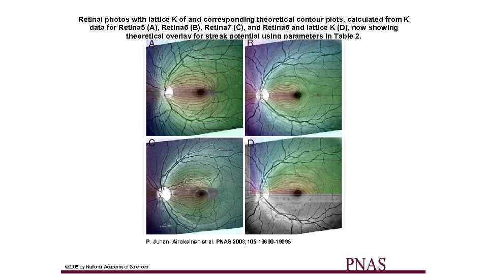 Retinal photos with lattice K of and corresponding theoretical contour plots, calculated from K