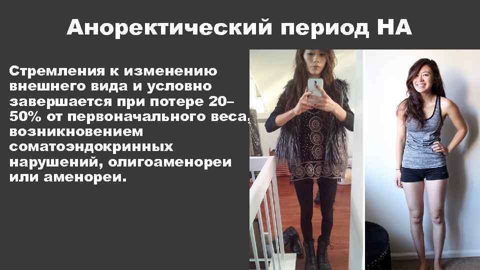 Аноректический период НА Стремления к изменению внешнего вида и условно завершается при потере 20–