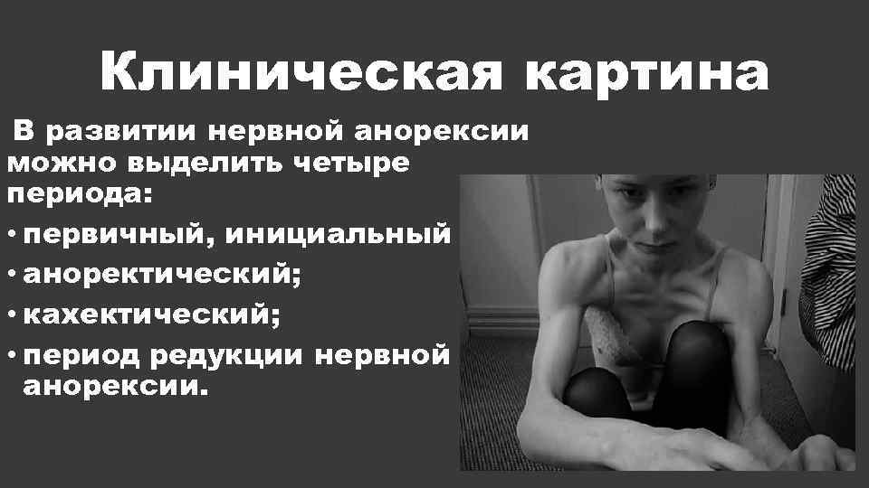 Клиническая картина В развитии нервной анорексии можно выделить четыре периода: • первичный, инициальный •