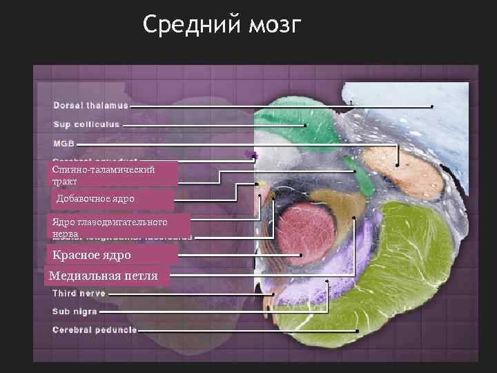 Средний мозг Спинно-таламический тракт Добавочное ядро Ядро глазодвигательного нерва Красное ядро Медиальная петля 