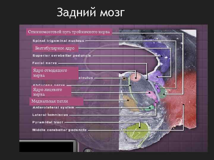 Задний мозг Спинномозговой путь тройничного нерва Вестибулярное ядро Ядро отводящего нерва Ядро лицевого нерва