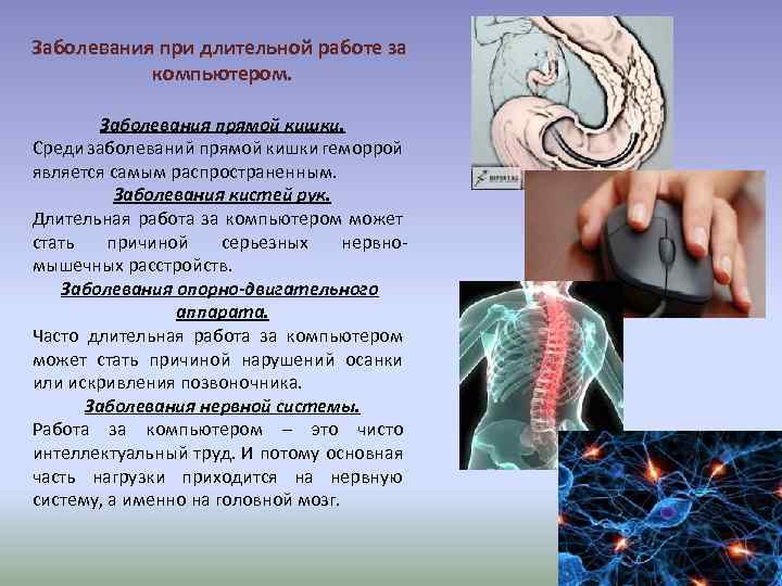 Заболевания при длительной работе за компьютером. Заболевания прямой кишки. Среди заболеваний прямой кишки геморрой