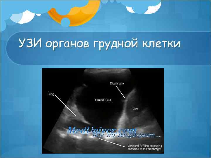 УЗИ органов грудной клетки 