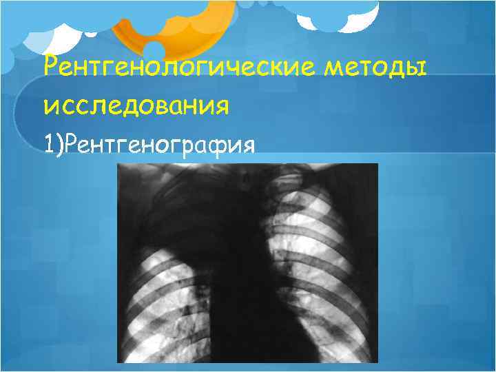 Рентгенологические методы исследования 1)Рентгенография 