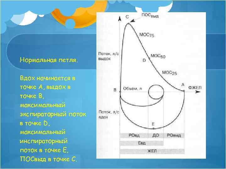 Нормальная петля. Вдох начинается в точке А, выдох в точке В, максимальный экспираторный поток