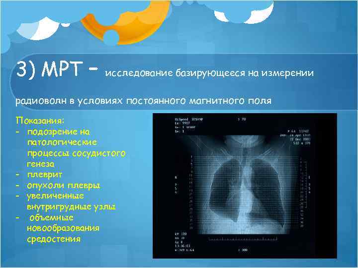 3) МРТ – исследование базирующееся на измерении радиоволн в условиях постоянного магнитного поля Показания: