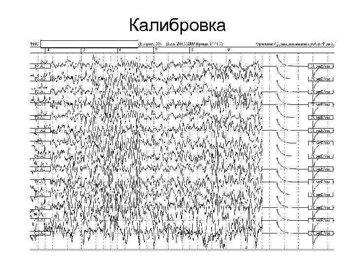 Калибровка 