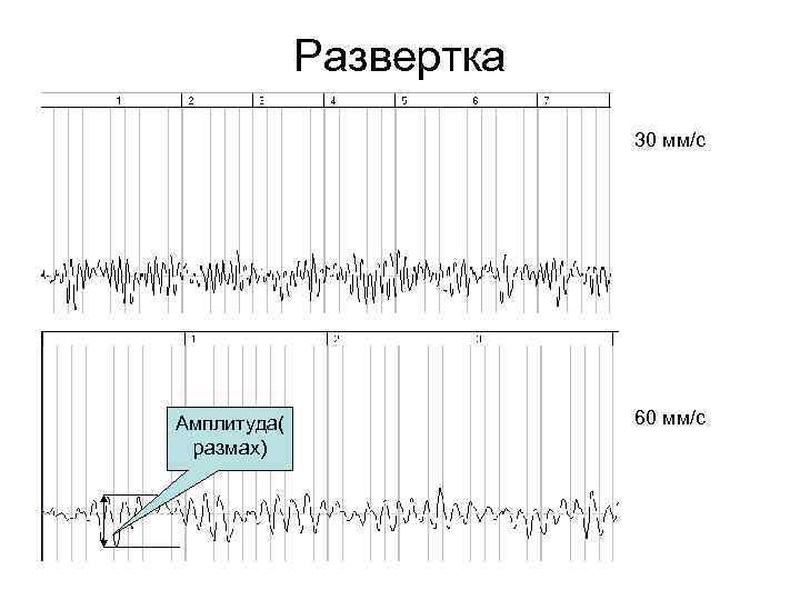 Развертка 30 мм/с Амплитуда( размах) 60 мм/с 