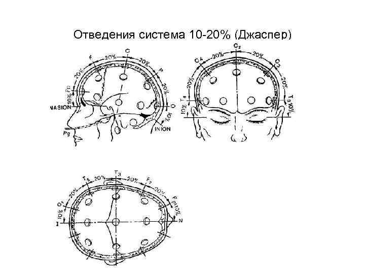 Отведения система 10 -20% (Джаспер) 