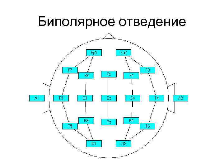 Биполярное отведение 