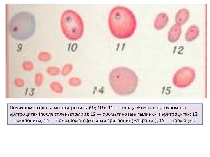 Полихроматофильные эритроциты (9); 10 и 11 — тельца Жолли в ортохромных эритроцитах (после спленэктомии);