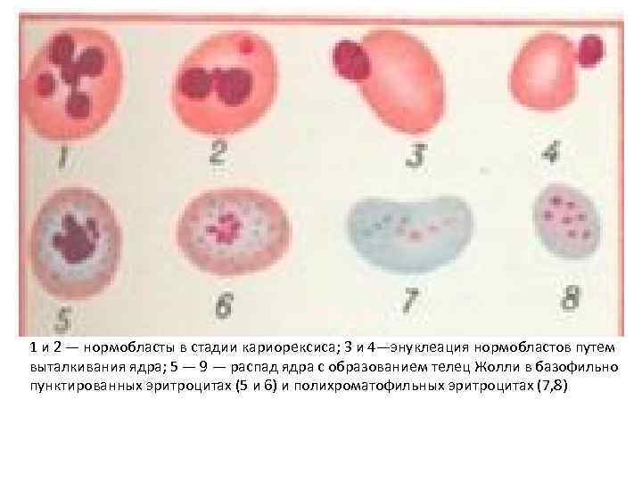 1 и 2 — нормобласты в стадии кариорексиса; 3 и 4—энуклеация нормобластов путем выталкивания